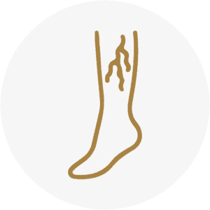 Icône varices