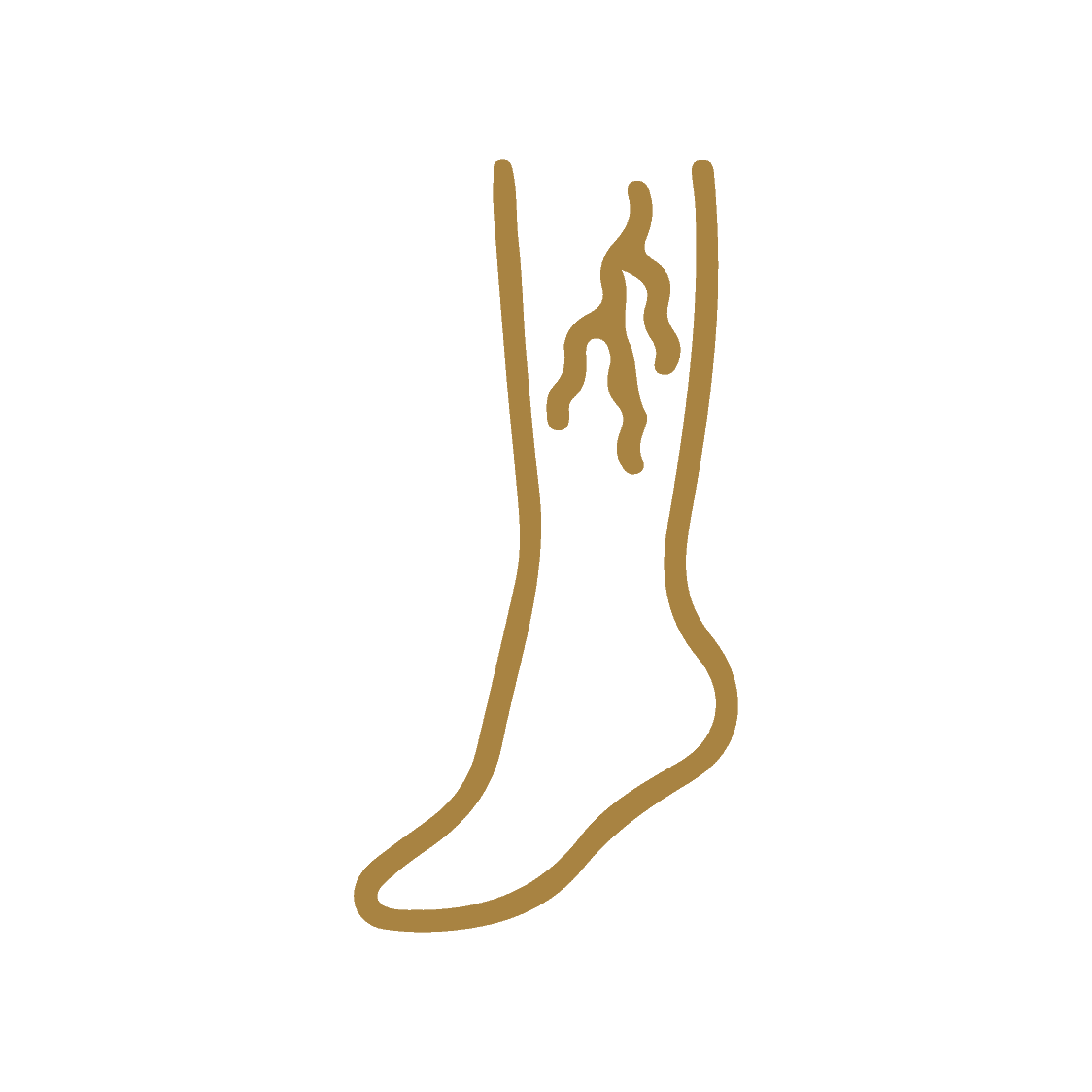 Varicose Veins