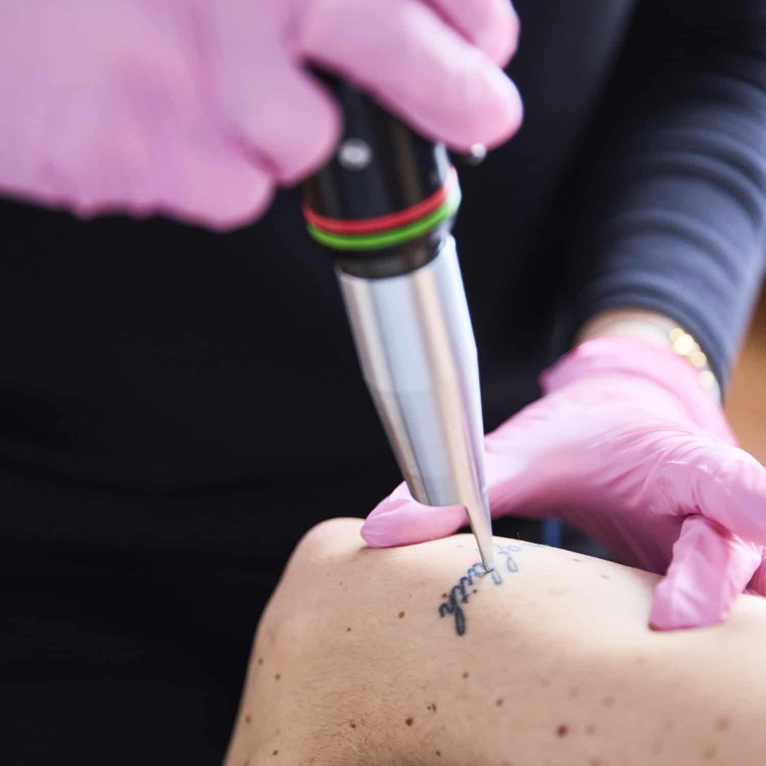 CLINIQUED_LASER_8372 (1)